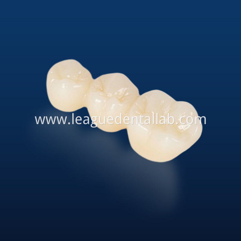 Full Zirconia crown,Full contour zirconia,Solid Zirconia,Zirconia,Monolithic Zirconia